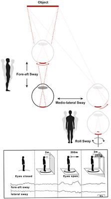 Susceptibility to Fear of Heights in Bilateral Vestibulopathy and Other Disorders of Vertigo and Balance